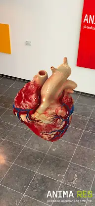 INSIGHT HEART Enterprise screenshot 3