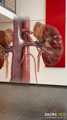 INSIGHT KIDNEY Enterprise screenshot 3