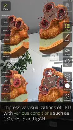 INSIGHT KIDNEY screenshot 7