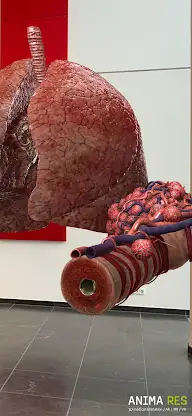 INSIGHT LUNG Enterprise screenshot 4