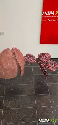 INSIGHT LUNG Enterprise screenshot 5