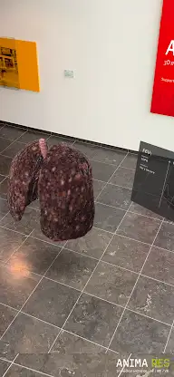 INSIGHT LUNG Enterprise screenshot 7