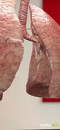 INSIGHT LUNG Enterprise screenshot 6