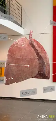 INSIGHT LUNG Enterprise screenshot 3