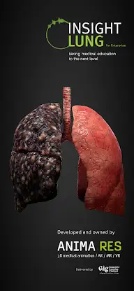 INSIGHT LUNG Enterprise screenshot 1