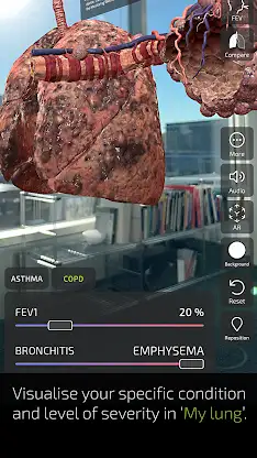 INSIGHT LUNG screenshot 7