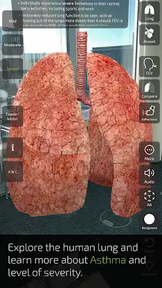 INSIGHT LUNG screenshot 5