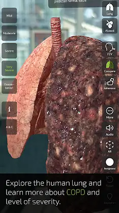INSIGHT LUNG screenshot 6