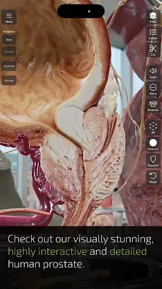 INSIGHT PROSTATE screenshot 3