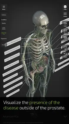 INSIGHT PROSTATE screenshot 7