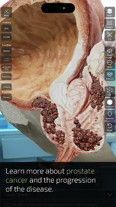 INSIGHT PROSTATE screenshot 6