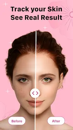 GlowLog: Skincare Tracker screenshot 1