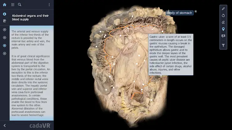 cadaVR anatomy screenshot 4