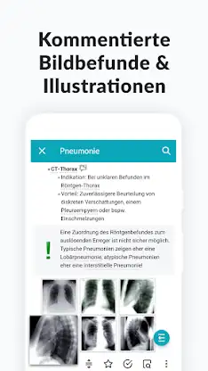 AMBOSS Medizin- & Pflegewissen screenshot 7